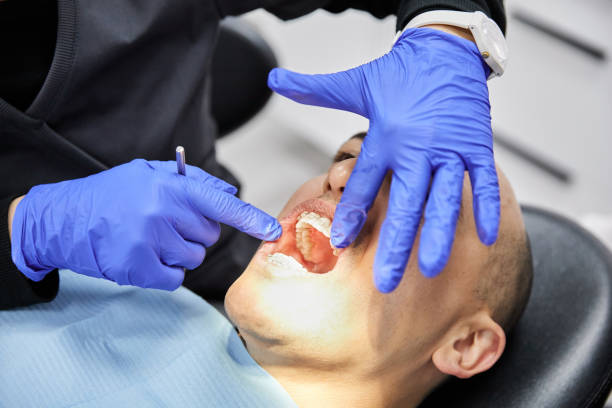 Best Emergency Dentist for Lost Fillings or Crowns in Kingsley, IA