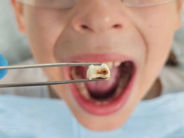 Best Orthodontic Emergency Dentist in Kingsley, IA